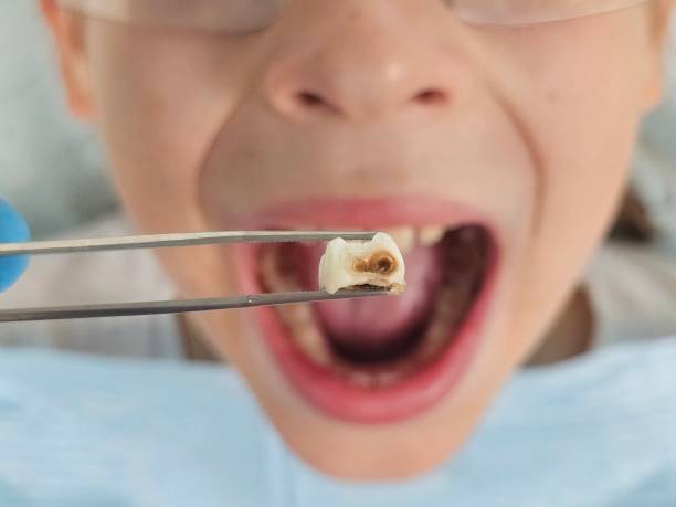  , WY Emergency Dentist Pros
